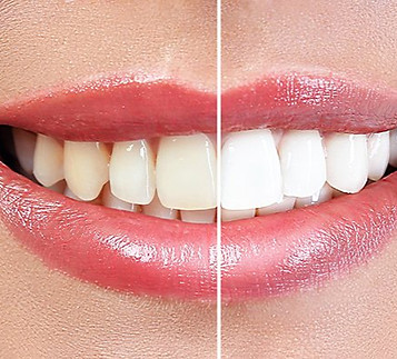 Cosmetic Dentistry