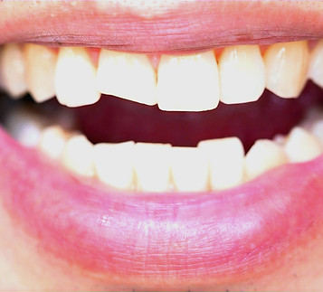 Restorative Dentistry
